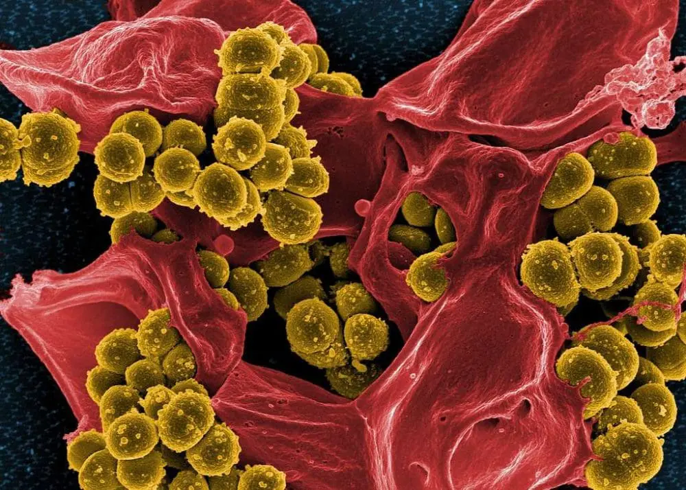 Microscopic view of golden-yellow Staphylococcus aureus bacteria clustered on a red human tissue surface. This bacteria, which causes staph infections, is commonly found in hospitals and healthcare settings