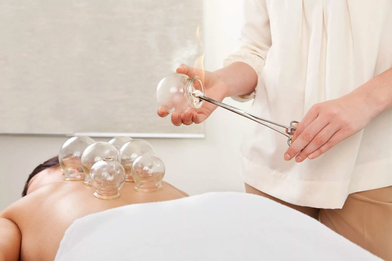 technician performing cupping therapy on a patient